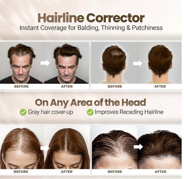 Medium Brown Root Touch Up & Gray Hair Concealer Powder - 4g - Horizon Endless